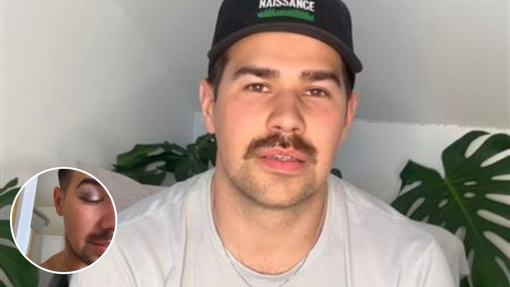 Yannick d’OD victime d’un fâcheux accident
